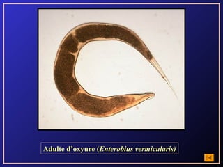 Adulte d’oxyure (Enterobius vermicularis)
 