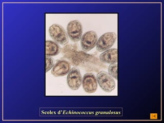 Scolex d’Echinococcus granulosus
 