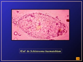 Œuf de Schistosoma haematobium
 