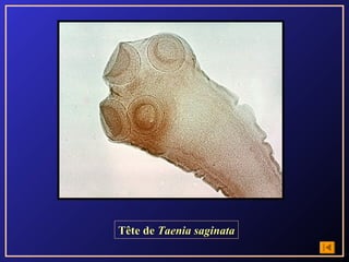 Tête de Taenia saginata
 
