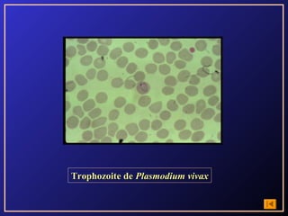 Trophozoite de Plasmodium vivax
 