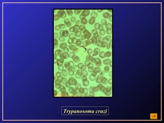 Trypanosoma cruzi
 