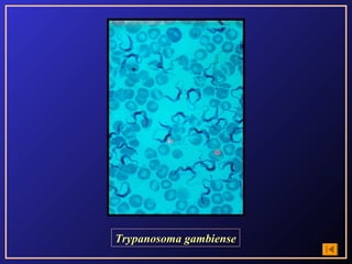 Trypanosoma gambiense
 