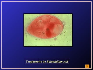 Trophozoite de Balantidium coli
 