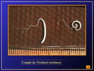 Couple de Trichuris trichiura
 
