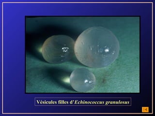 Vésicules filles d’Echinococcus granulosus
 