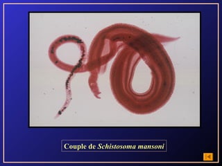 Couple de Schistosoma mansoni
 