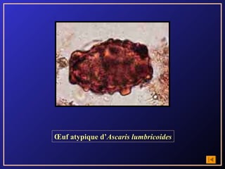 Œuf atypique d’Ascaris lumbricoides
 