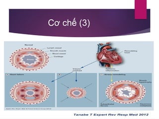 Comprehensive Overview of Acute Heart Failure and Pulmonary Edema ...