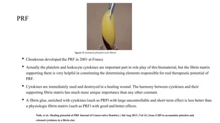 PERIAPICAL WOUND HEALING | PPTX