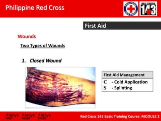 Philippine Red Cross
Always Always Always
FIRST READY THERE
Red Cross 143 Basic Training Course: MODULE 2
First Aid
Wounds
Two Types of Wounds
1. Closed Wound
First Aid Management
C - Cold Application
S - Splinting
 