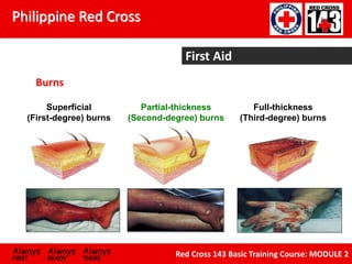 Philippine Red Cross
Always Always Always
FIRST READY THERE
Red Cross 143 Basic Training Course: MODULE 2
First Aid
Burns
Superficial
(First-degree) burns
Partial-thickness
(Second-degree) burns
Full-thickness
(Third-degree) burns
 