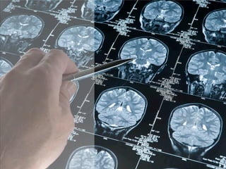 PhRMA Chart Pack: Biopharmaceuticals in Perspective (Spring 2013)