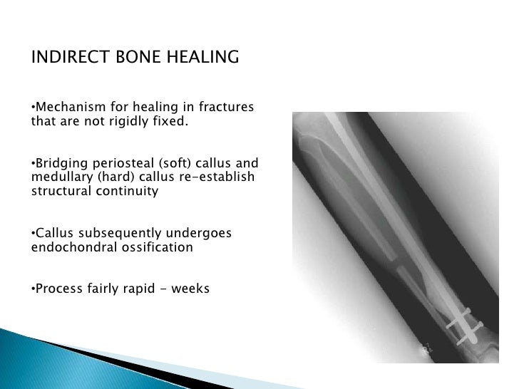 Phsiology of fractures