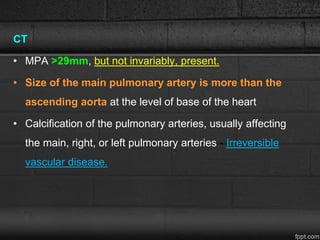 CT
• MPA >29mm, but not invariably, present.
• Size of the main pulmonary artery is more than the
ascending aorta at the level of base of the heart
• Calcification of the pulmonary arteries, usually affecting
the main, right, or left pulmonary arteries - Irreversible
vascular disease.
 
