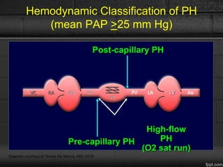 Pre-capillary PH
High-flow
PH
(O2 sat run)
Hemodynamic Classification of PH
(mean PAP >25 mm Hg)
VC RA RV PA PV
PC
LA LV Ao
Post-capillary PH
Diagram courtesy of Teresa De Marco, MD, UCSF
 