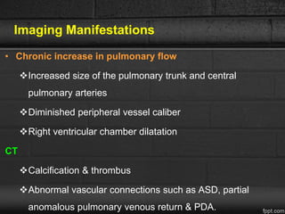 • Chronic increase in pulmonary flow
Increased size of the pulmonary trunk and central
pulmonary arteries
Diminished peripheral vessel caliber
Right ventricular chamber dilatation
CT
Calcification & thrombus
Abnormal vascular connections such as ASD, partial
anomalous pulmonary venous return & PDA.
Imaging Manifestations
 