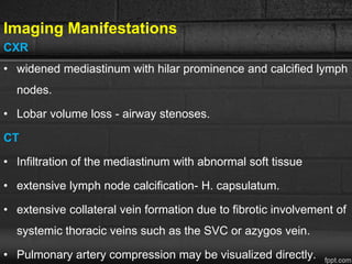 Imaging Manifestations
CXR
• widened mediastinum with hilar prominence and calcified lymph
nodes.
• Lobar volume loss - airway stenoses.
CT
• Infiltration of the mediastinum with abnormal soft tissue
• extensive lymph node calcification- H. capsulatum.
• extensive collateral vein formation due to fibrotic involvement of
systemic thoracic veins such as the SVC or azygos vein.
• Pulmonary artery compression may be visualized directly.
 