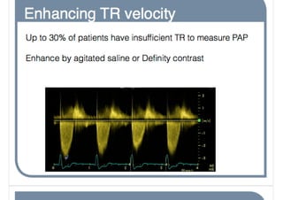 Pht Risk Score Pht good, bad and ugly.key