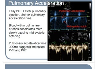 Pht Sheet Pht good, bad and ugly.key