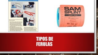 TIPOS DE
FERULAS
 