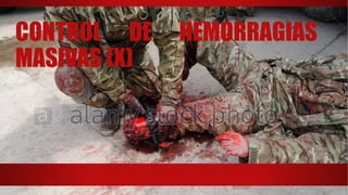 CONTROL DE HEMORRAGIAS
MASIVAS (X)
 