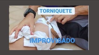 Vendajes de Compresión
Materiales Alternativos
En caso de no disponer de vendajes de
compresión, usa cualquier elemento
disponible, como toallas, ropa o cinturones.
Técnica de Compresión
Recuerda que la técnica de compresión es
fundamental para reducir el flujo de sangre.
Aplica una presión firme y envuelve
firmemente la herida para mantener la
compresión.
Signos Vitales
Controla los signos vitales del paciente para
evaluar su estabilidad y su respuesta al
tratamiento de la herida.
Observación Continua
Asegúrate de observar de forma continua al
paciente y de anticipar un posible deterioro
de su condición.
 