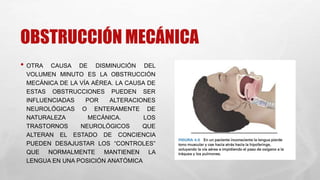 OBSTRUCCIÓN MECÁNICA
• OTRA CAUSA DE DISMINUCIÓN DEL
VOLUMEN MINUTO ES LA OBSTRUCCIÓN
MECÁNICA DE LA VÍA AÉREA. LA CAUSA DE
ESTAS OBSTRUCCIONES PUEDEN SER
INFLUENCIADAS POR ALTERACIONES
NEUROLÓGICAS O ENTERAMENTE DE
NATURALEZA MECÁNICA. LOS
TRASTORNOS NEUROLÓGICOS QUE
ALTERAN EL ESTADO DE CONCIENCIA
PUEDEN DESAJUSTAR LOS “CONTROLES”
QUE NORMALMENTE MANTIENEN LA
LENGUA EN UNA POSICIÓN ANATÓMICA
 