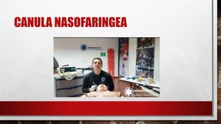 CANULA NASOFARINGEA
 