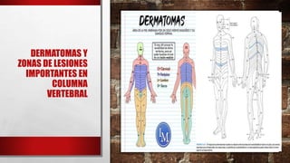 DERMATOMAS Y
ZONAS DE LESIONES
IMPORTANTES EN
COLUMNA
VERTEBRAL
 