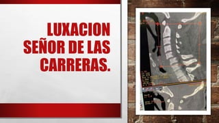 LUXACION
SEÑOR DE LAS
CARRERAS.
 
