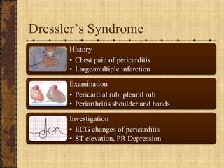 Dressler’s Syndrome