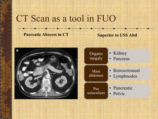 CT Scan as a tool in FUOPacreatic Abscess in CTSuperior to USS Abd