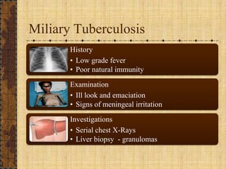 Miliary Tuberculosis