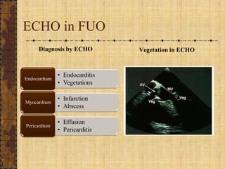 ECHO in FUODiagnosis by ECHOVegetation in ECHO