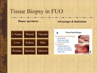Tissue Biopsy in FUOBiopsy specimensAdvantages & limitations