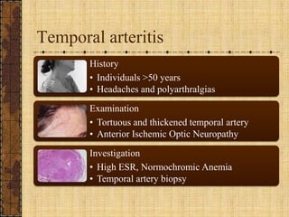 Temporal arteritis