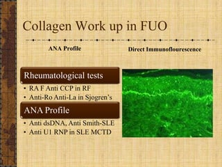 Collagen Work up in FUOANA ProfileDirect Immunoflourescence