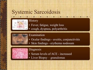 Systemic Sarcoidosis