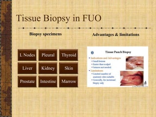 Tissue Biopsy in FUO<br />Biopsy specimens<br />Advantages & limitations<br />