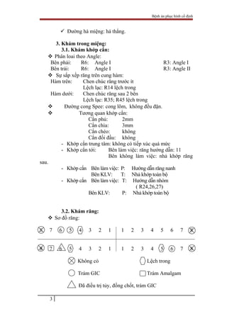 Bệnh án phục hình cố định
 Đường há miệng: há thẳng.
3. Khám trong miệng:
3.1. Khám khớp cắn:
 Phân loai theo Angle:
Bên phải: R6: Angle I R3: Angle I
Bên trái: R6: Angle I R3: Angle II
 Sự sắp xếp răng trên cung hàm:
Hàm trên: Chen chúc răng trước ít
Lệch lạc: R14 lệch trong
Hàm dưới: Chen chúc răng sau 2 bên
Lệch lạc: R35; R45 lệch trong
 Đường cong Spee: cong lõm, không đều đặn.
 Tương quan khớp cắn:
Cắn phủ: 2mm
Cắn chìa: 3mm
Cắn chéo: không
Cắn đối đầu: không
- Khớp cắn trung tâm: không có tiếp xúc quá mức
- Khớp cắn tới: Bên làm việc: răng hướng dẫn: 11
Bên không làm việc: nhả khớp răng
sau.
- Khớp cắn Bên làm việc: P: Hướng dẫn răng nanh
Bên KLV: T: Nhả khớp toàn bộ
- Khớp cắn Bên làm việc: T: Hướng dẫn nhóm
( R24,26,27)
Bên KLV: P: Nhả khớp toàn bộ
3.2. Khám răng:
 Sơ đồ răng:
8 7 6 5 4 3 2 1 1 2 3 4 5 6 7 8
8 7 6 5 4 3 2 1 1 2 3 4 5 6 7 8
Không có Lệch trong
Trám GIC Trám Amalgam
Đã điều trị tủy, đống chốt, trám GIC
3
 