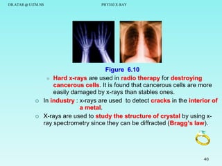DR.ATAR @ UiTM.NS




PHY310 X-RAY

Figure 6.10
 Hard x-rays are used in radio therapy for destroying
cancerous cells. It is found that cancerous cells are more
easily damaged by x-rays than stables ones.
In industry : x-rays are used to detect cracks in the interior of
a metal.
X-rays are used to study the structure of crystal by using xray spectrometry since they can be diffracted (Bragg’s law).

40

 