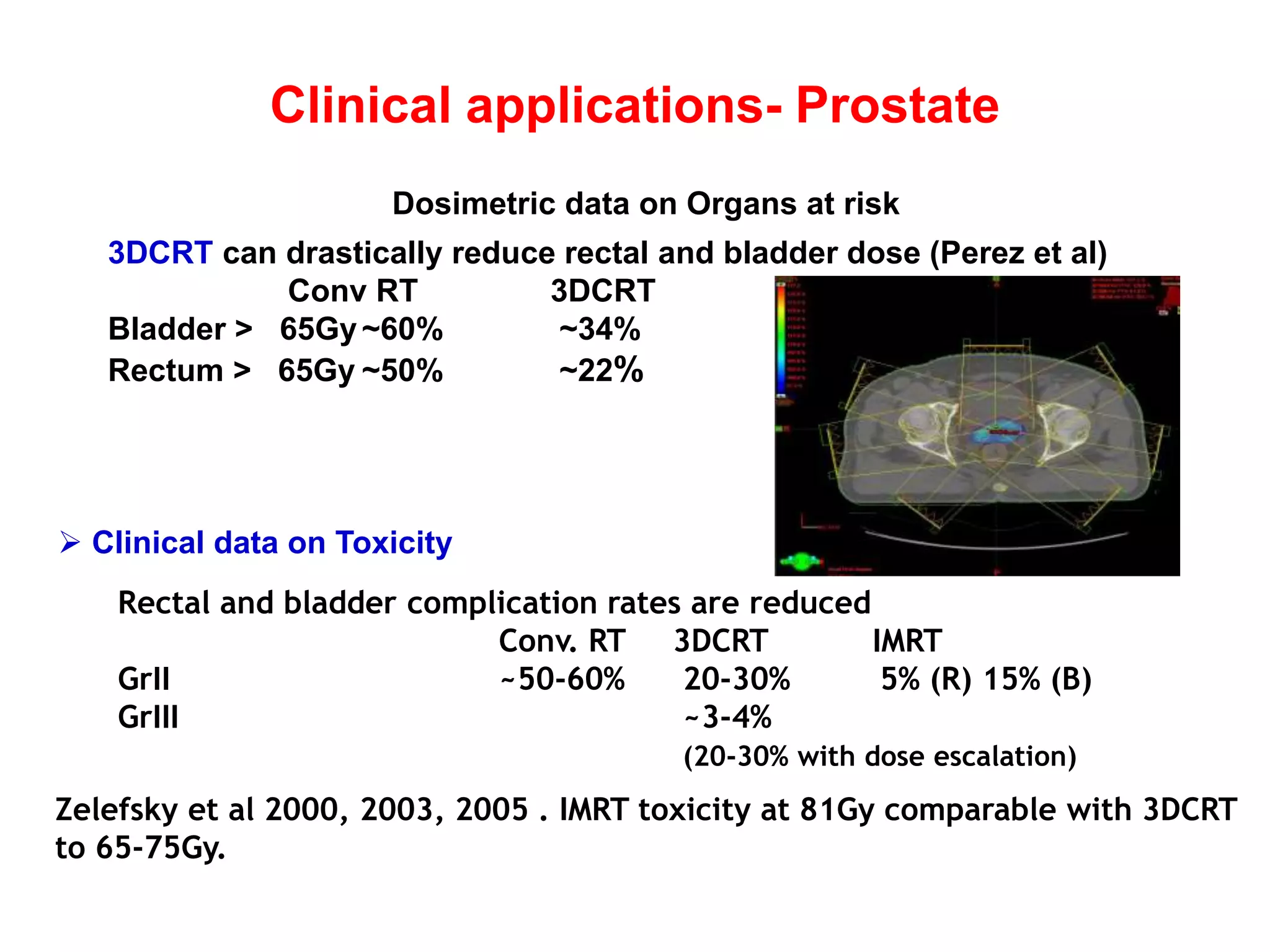 Three dimensional conformal radiotherapy - 3D-CRT and IMRT - Intensity ...