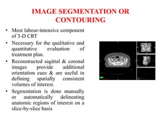 Three dimensional conformal radiotherapy - 3D-CRT and IMRT - Intensity ...