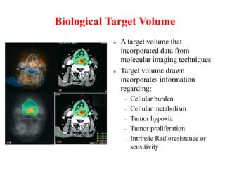 Three dimensional conformal radiotherapy - 3D-CRT and IMRT - Intensity ...