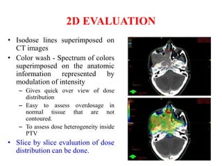 Three dimensional conformal radiotherapy - 3D-CRT and IMRT - Intensity ...