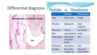 Differential diagnosis
 