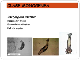 Dactylogyrus vastator Hospedador: Peces Ectoparásitos dérmicos. Piel y branquias. CLASE MONOGENEA 