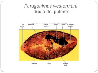 Paragonimus westermani   duela del pulmón 