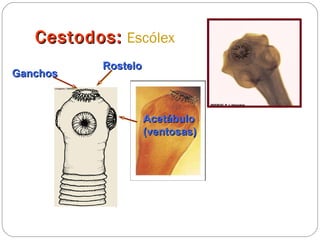 Cestodos:   Escólex Rostelo Ganchos Acetábulo (ventosas) 